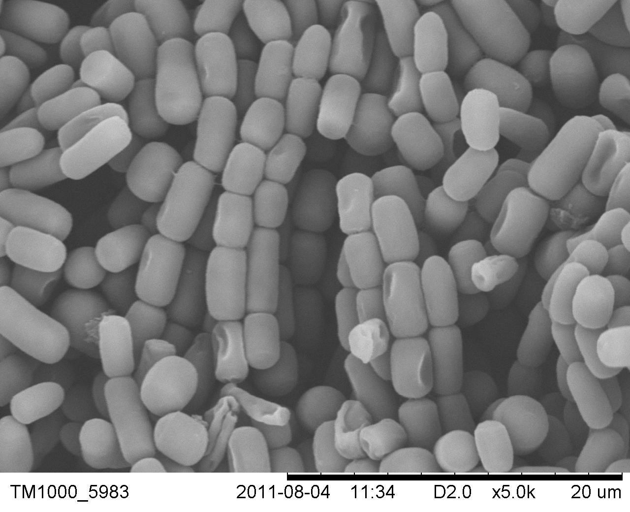 口腔变异链球菌--致龋齿呼吸道黏膜上皮细胞纤毛脱落会后,孙异临研究