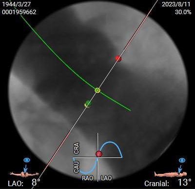主動脈鈣化' 3D     金門美兆診所  WHO水針NGO