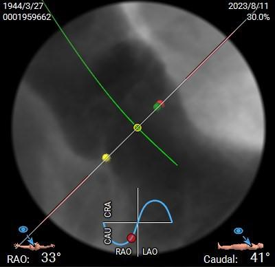 主動脈鈣化' 3D     金門美兆診所  WHO水針NGO