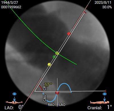 主動脈鈣化' 3D     金門美兆診所  WHO水針NGO