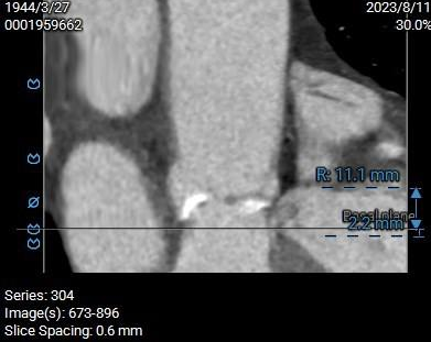 主動脈鈣化' 3D     金門美兆診所  WHO水針NGO
