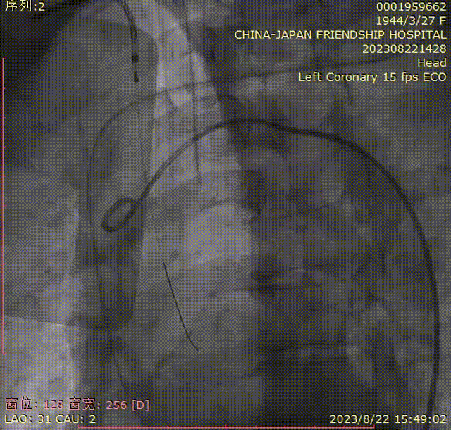 主動脈鈣化' 3D     金門美兆診所  WHO水針NGO