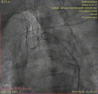 主動脈鈣化' 3D     金門美兆診所  WHO水針NGO