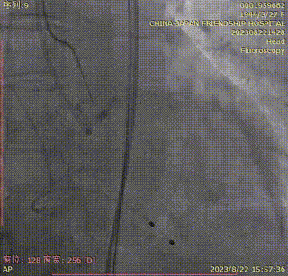 主動脈鈣化' 3D     金門美兆診所  WHO水針NGO