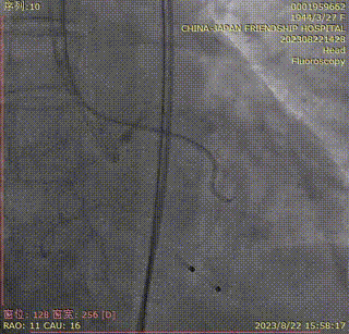 主動脈鈣化' 3D     金門美兆診所  WHO水針NGO