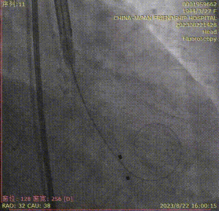 主動脈鈣化' 3D     金門美兆診所  WHO水針NGO