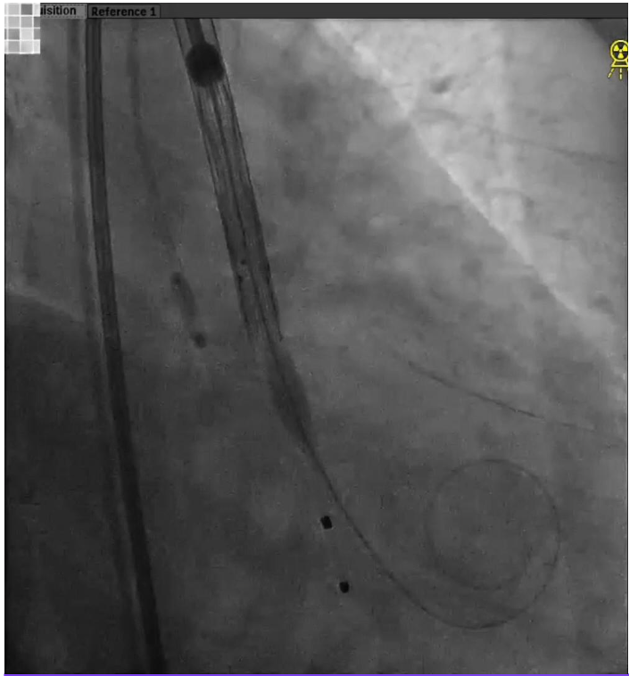 主動脈鈣化' 3D     金門美兆診所  WHO水針NGO