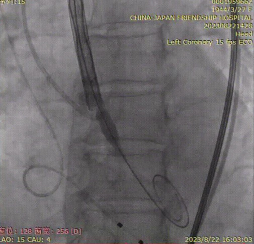 主動脈鈣化' 3D     金門美兆診所  WHO水針NGO