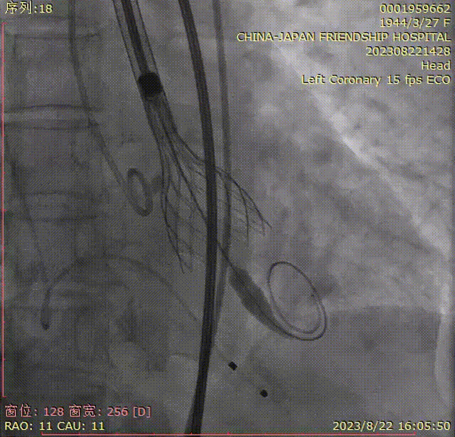 主動脈鈣化' 3D     金門美兆診所  WHO水針NGO