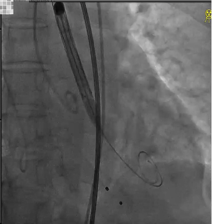 主動脈鈣化' 3D     金門美兆診所  WHO水針NGO