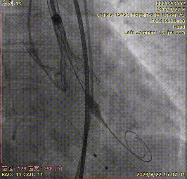 主動脈鈣化' 3D     金門美兆診所  WHO水針NGO