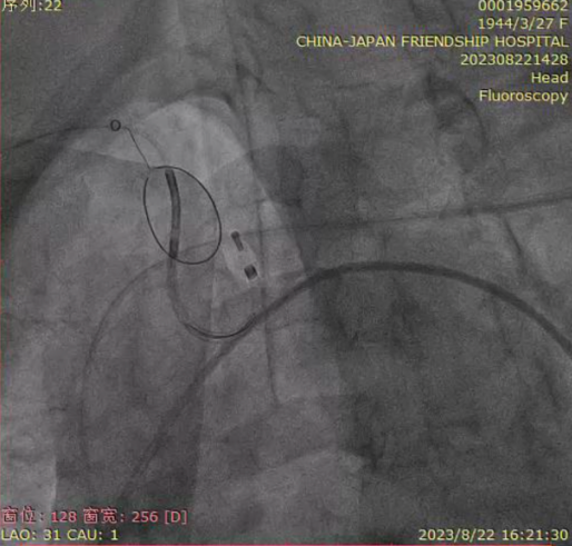 主動脈鈣化' 3D     金門美兆診所  WHO水針NGO