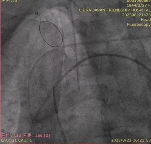 主動脈鈣化' 3D     金門美兆診所  WHO水針NGO