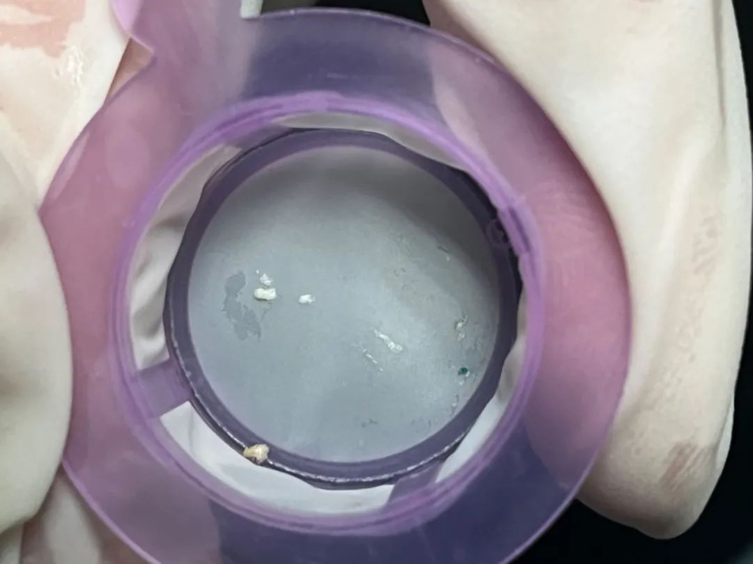 主動脈鈣化' 3D     金門美兆診所  WHO水針NGO